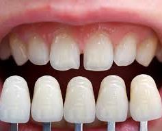 Teeth