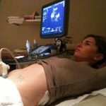 Pregnant woman having ultra sound